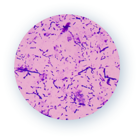 SIS Remodels Into Patient Tissue