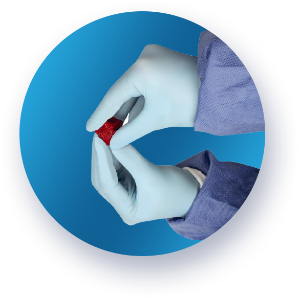Safely Debride a Wide Variety of Wounds