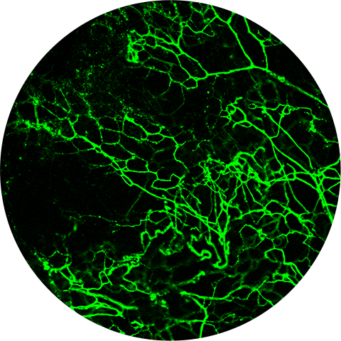 SIS Remodels Into Patient Tissue