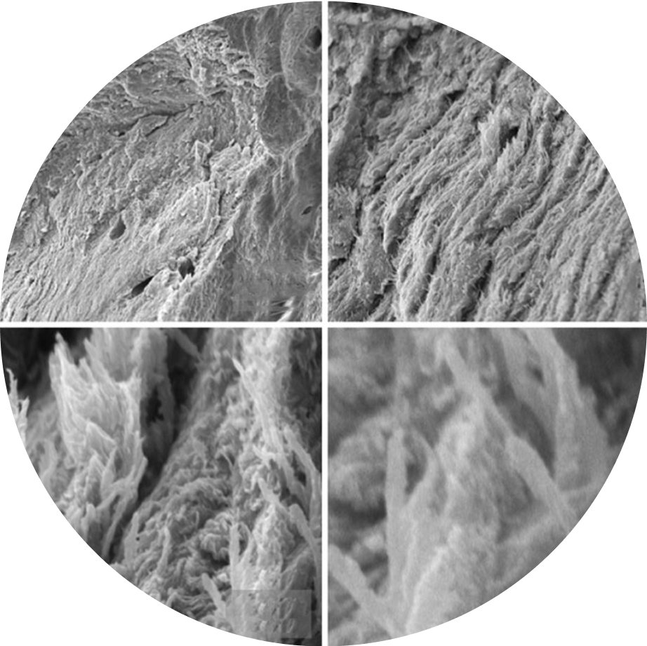 OsStic™ Technology