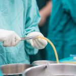surgeon prepping a surgical site drain