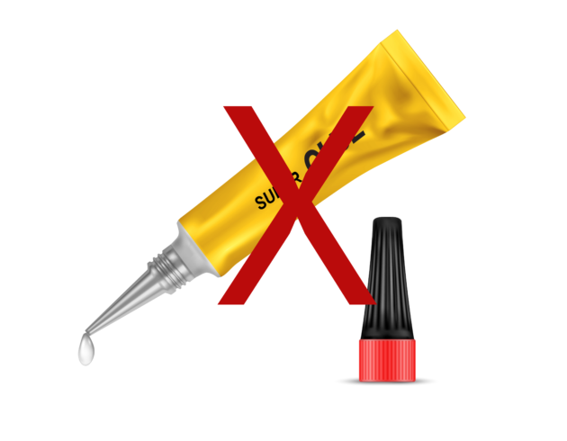 An Overview of Surgical Glues, Sealants and Other Adhesives