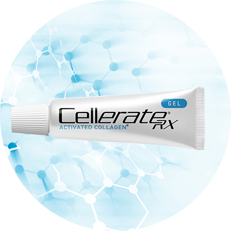 CellerateRX® Gel Activated Collagen