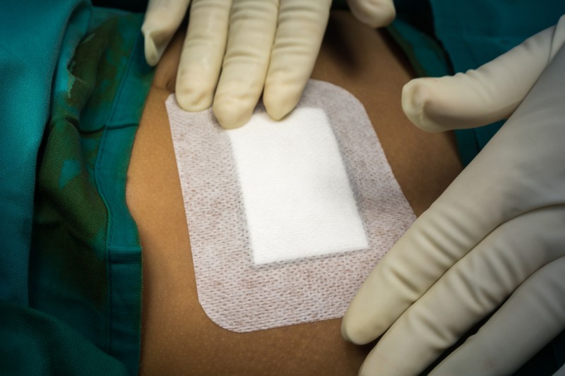 dressing options for dead space formation in surgical wounds